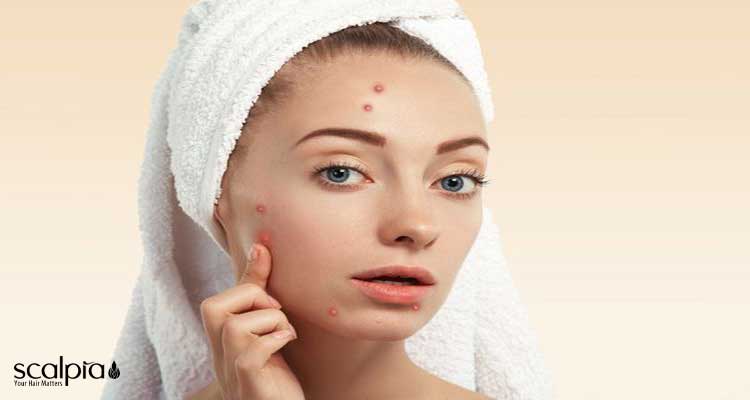 فواید درمانی سیندت ژل شستشوی پوست صورت و بدن