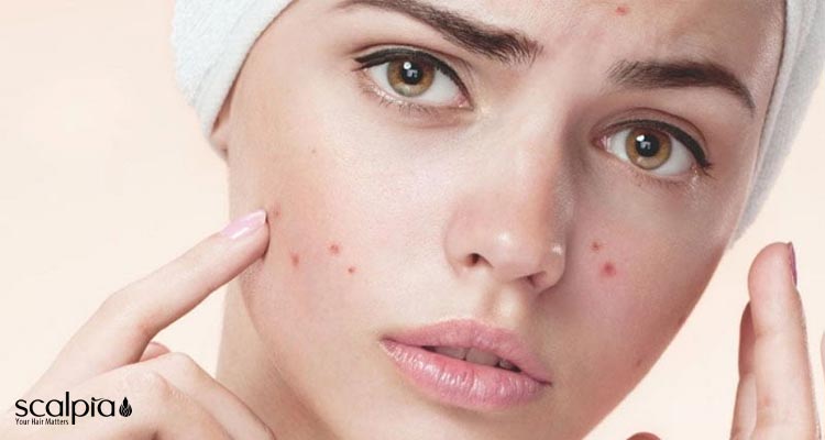 قیمت سیندت ژل شستشو